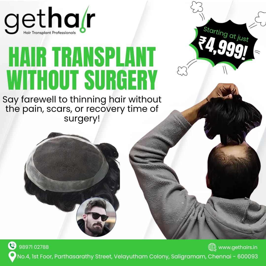 Non-surgical hair replacement in Chennai at GetHair
